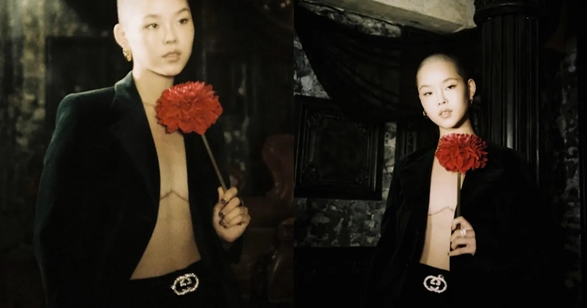 日 걸그룹 멤버, 유방 절제 흉터 공개하며 커밍아웃…"女로 보이는 것 불편"