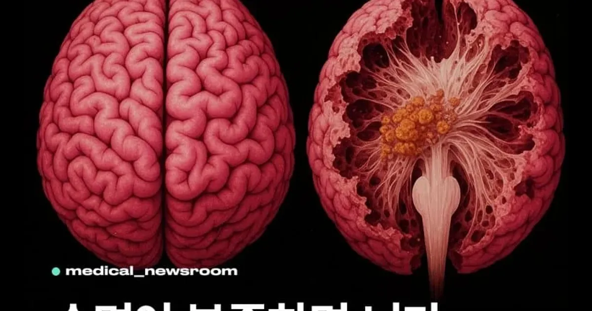 수면이 부족하면 뇌가 스스로를 잡아먹는다