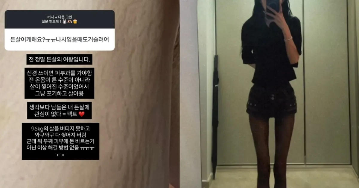 '故 최진실 딸' 최준희, 뼈말라 허벅지 튼살 공개…"96kg 버티지 못하고 찢어져"