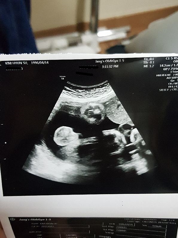 친자검사 해보고싶다는 남자친구