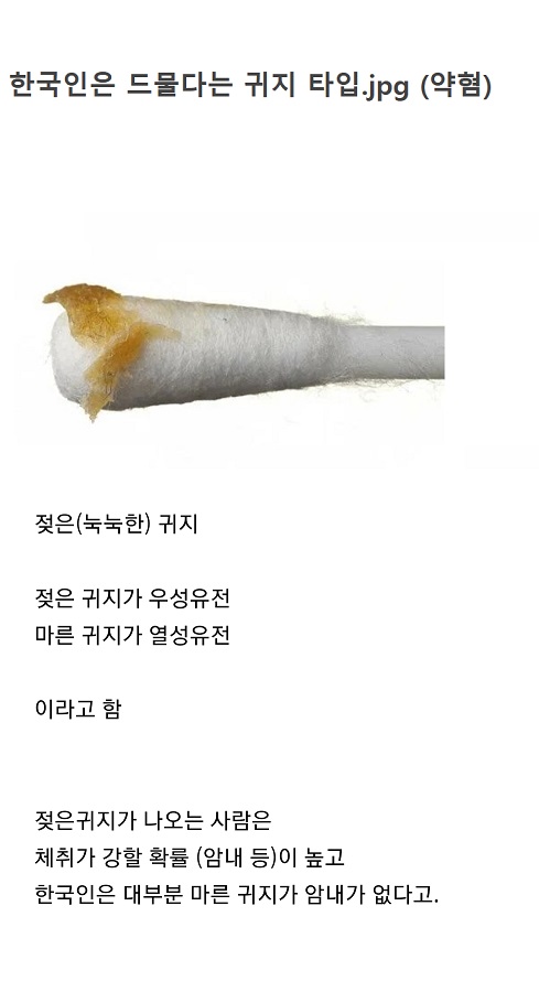 귀파는방 후기 5