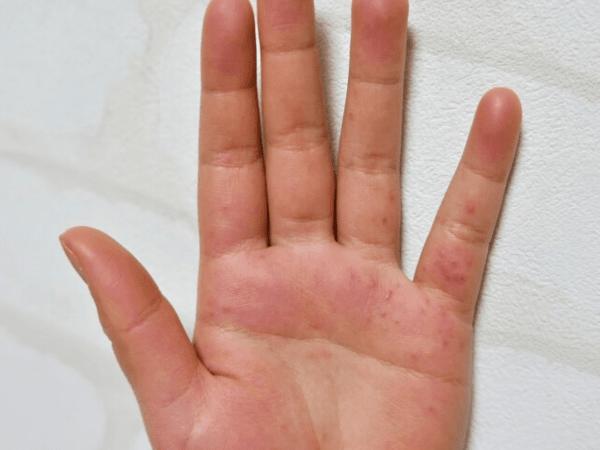 온라인 커뮤니티