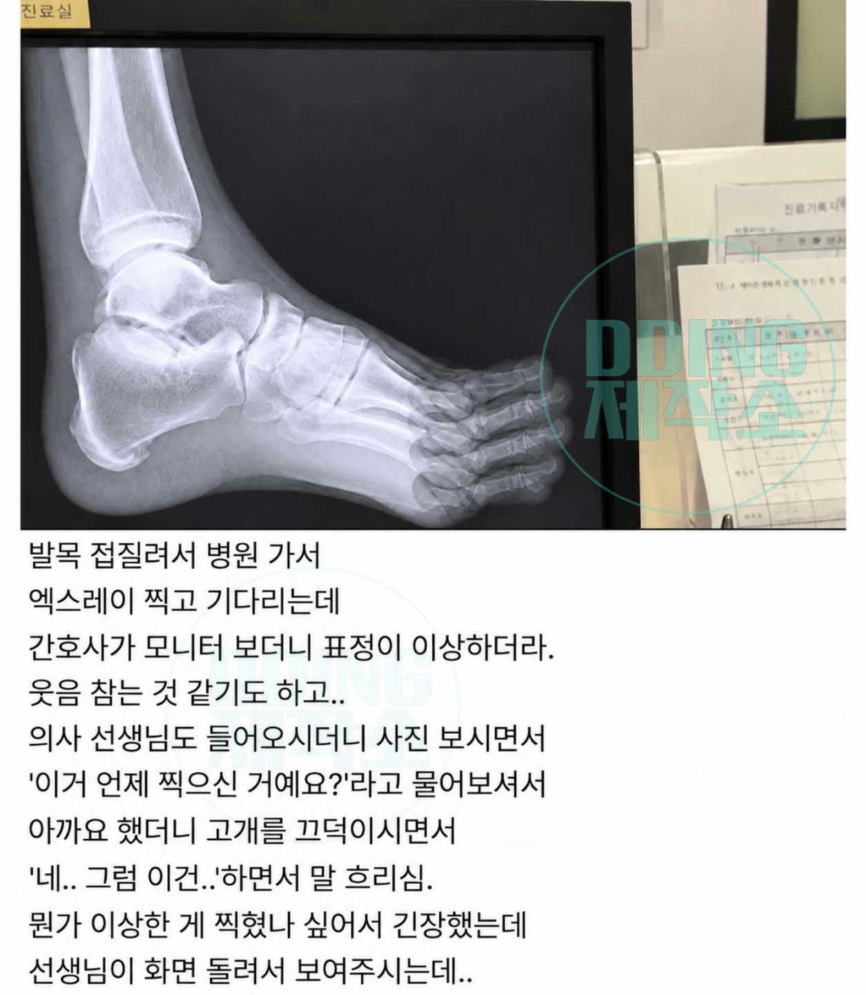 발목 엑스레이 사진 보더니 간호사가 계속 웃는데