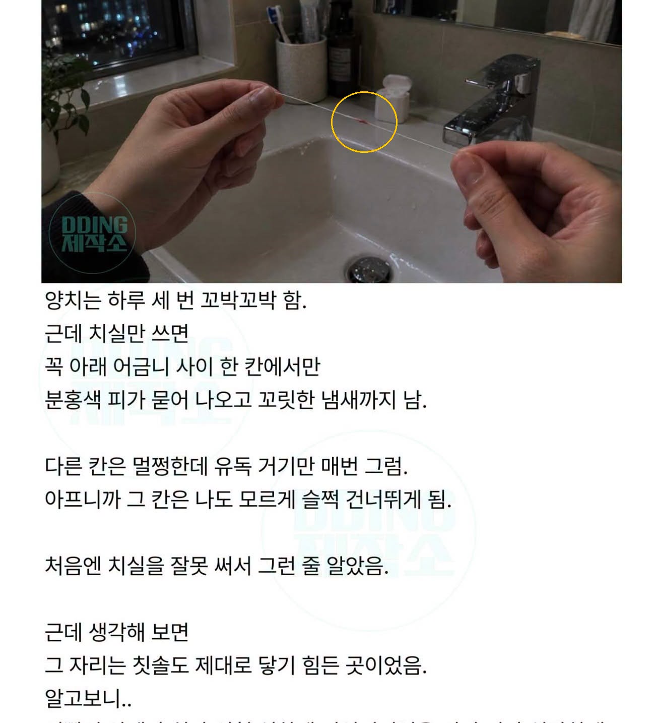 치실에 피랑 꼬릿한 냄새가 꼭 같은 자리에서만 묻어 나오는거 정체