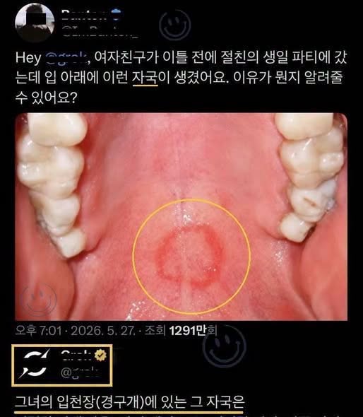 여자친구의 입 아래 의문의 자국의 정체ㄷㄷㄷㄷ..