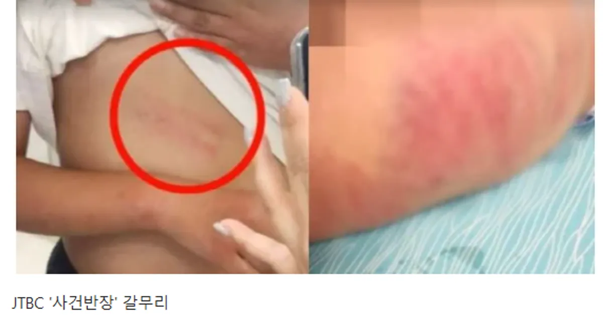 죽도록 때려서라도 훈육해주세요 했더니 손목골절