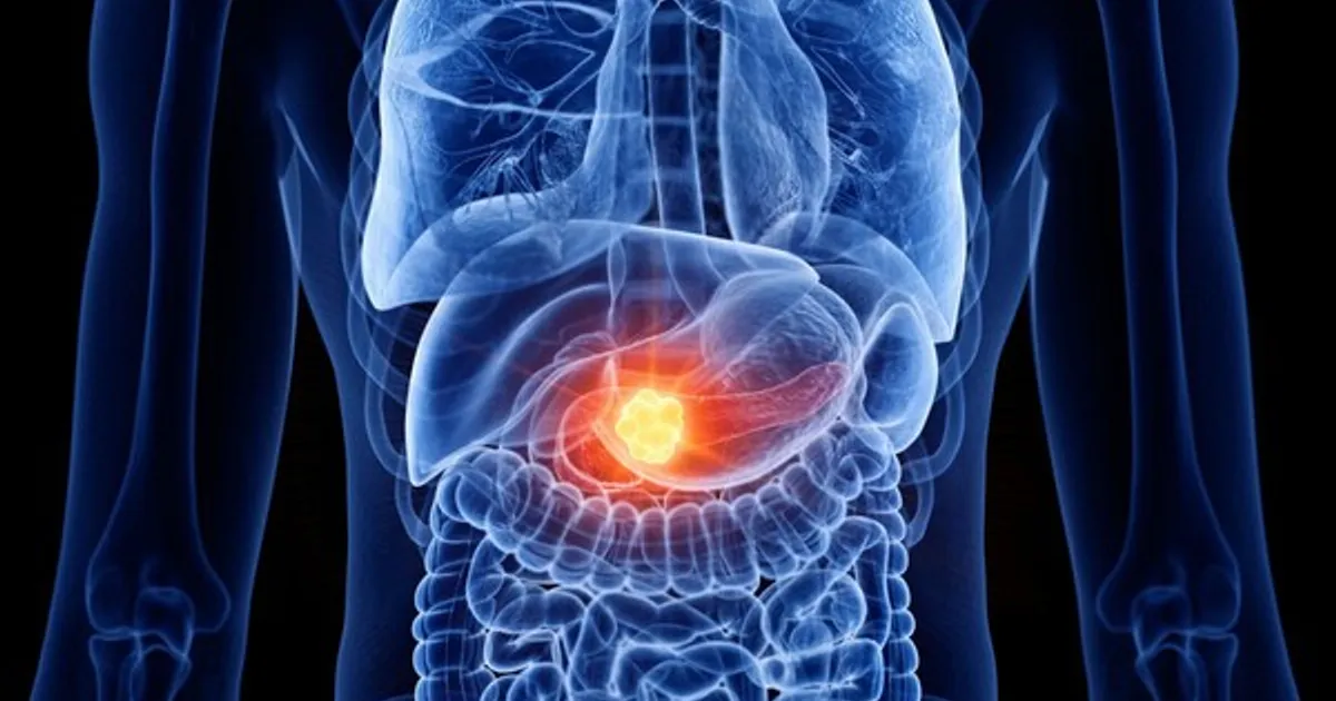 나도 모르게 "입이 이 상태라면" 췌장암 초기 신호입니다, 제발 조심하세요.