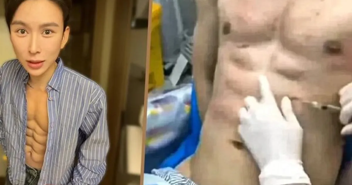 "운동 대신 주사 택했다"…8억 들인 8팩 복근남