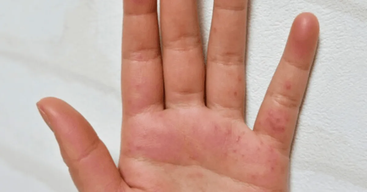 손이나 목에 "이런 증상" 보이면 단순통증 아닌 심각한 신경 이상입니다.