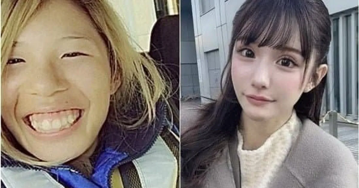 성형하고 인생바꾼 스시녀...JPG