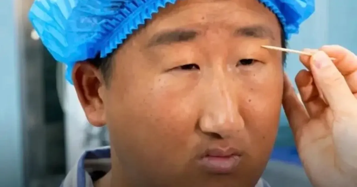 중국남성, 성형수술로 인생역전 ㅎㄷㄷ