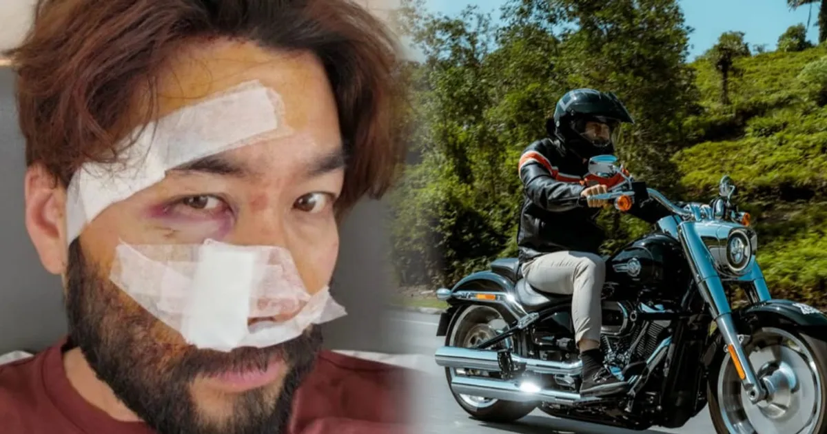 노홍철 "라이딩 중 오토바이에 깔려" 휠체어 신세...또 음주운전 의혹?(+바이크사고, 논란, 재산, 홍철책빵)