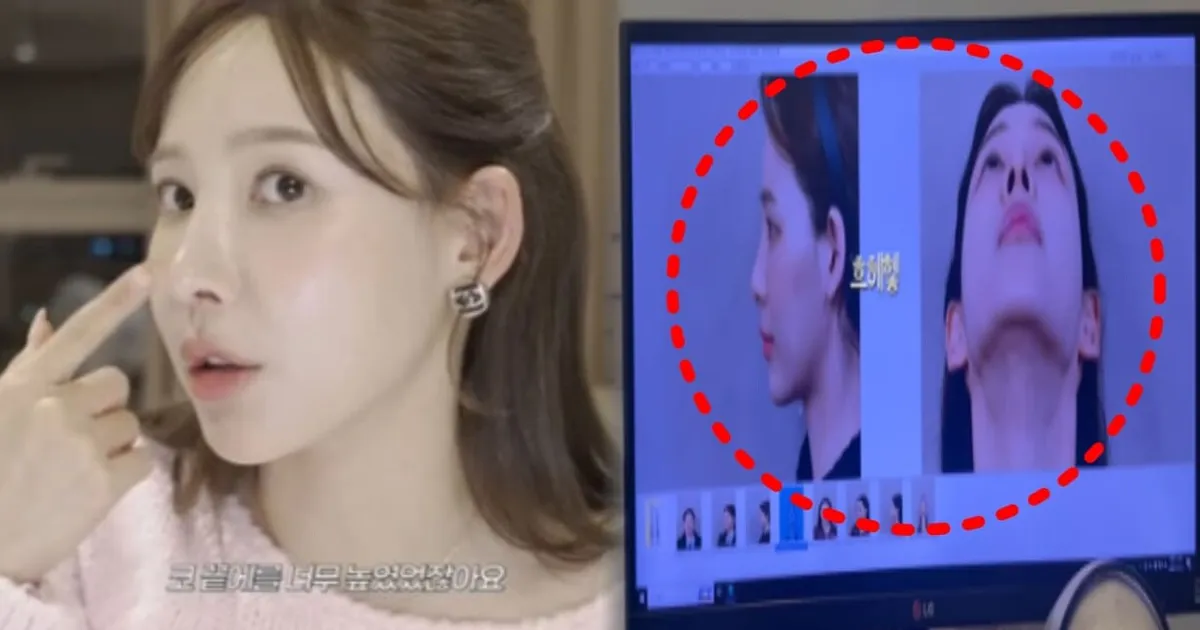 '환승연애2' 이나연, 코 재수술 근황 "예전 코로 복원"...성형 전 얼굴 재조명