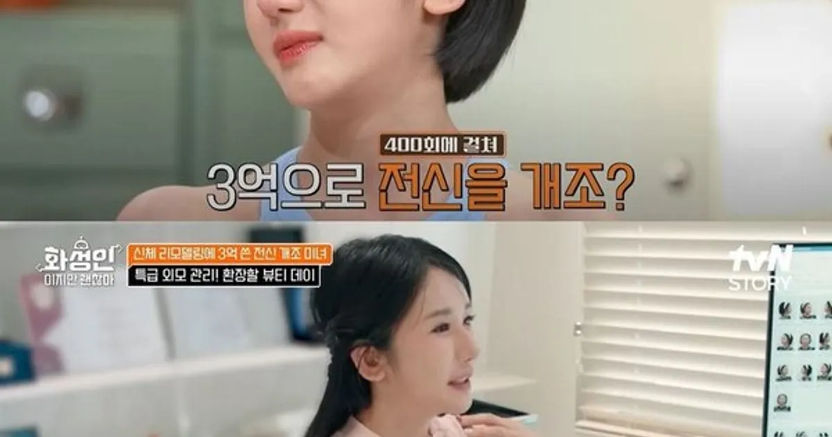 성형에 3억원 쓴 여성 "수술만 400회…치아도 내 거 아냐"