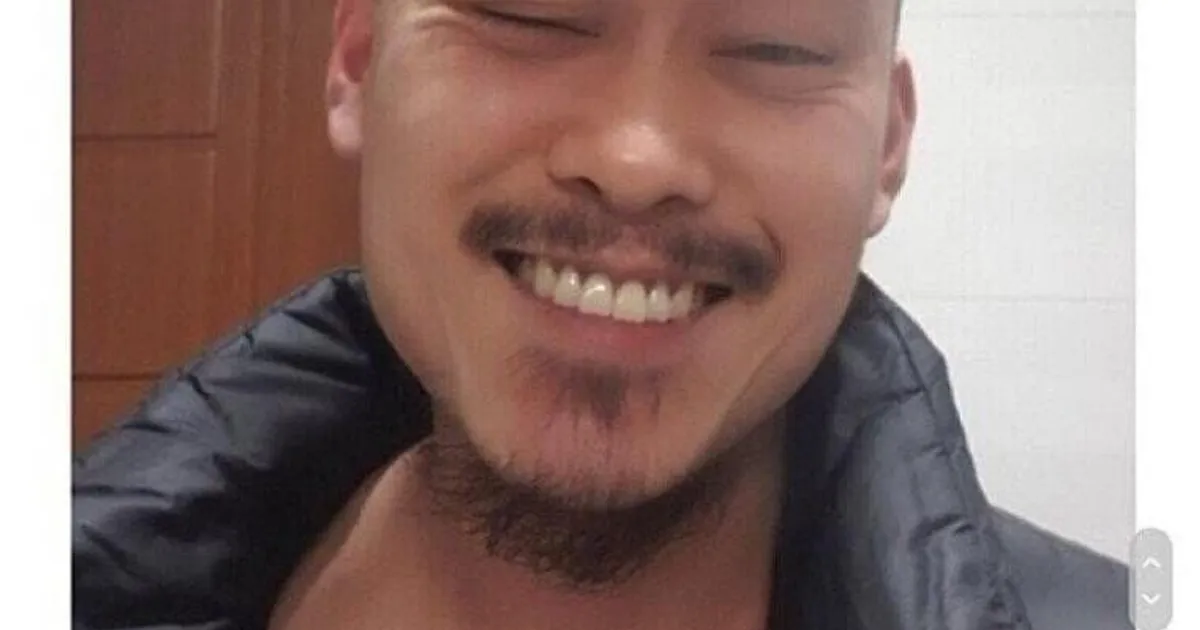 어느 디시인 탈모 인증 레전드		,,