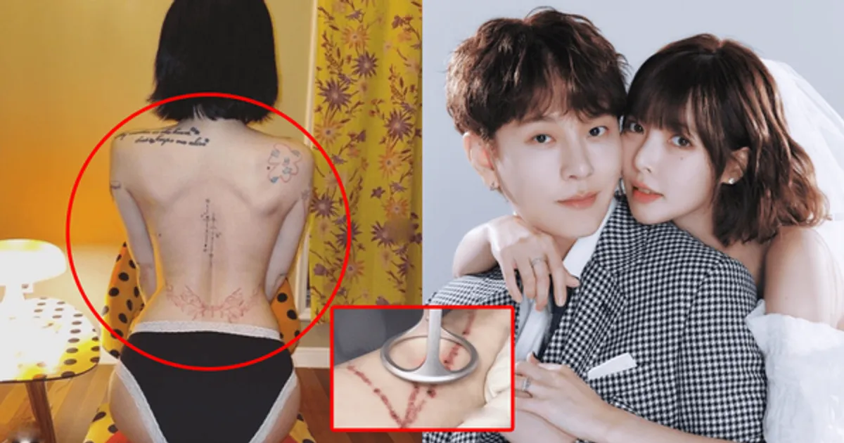 "엄마라는 이유"...현아, 용준형과 결혼 후 '전신 타투' 1년 째 지우는 중 고백 "애 낳고 타투 지워"